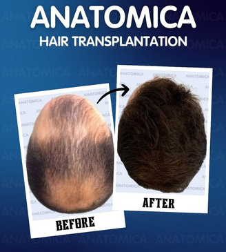 Slider image (8) Anatomica Clinic